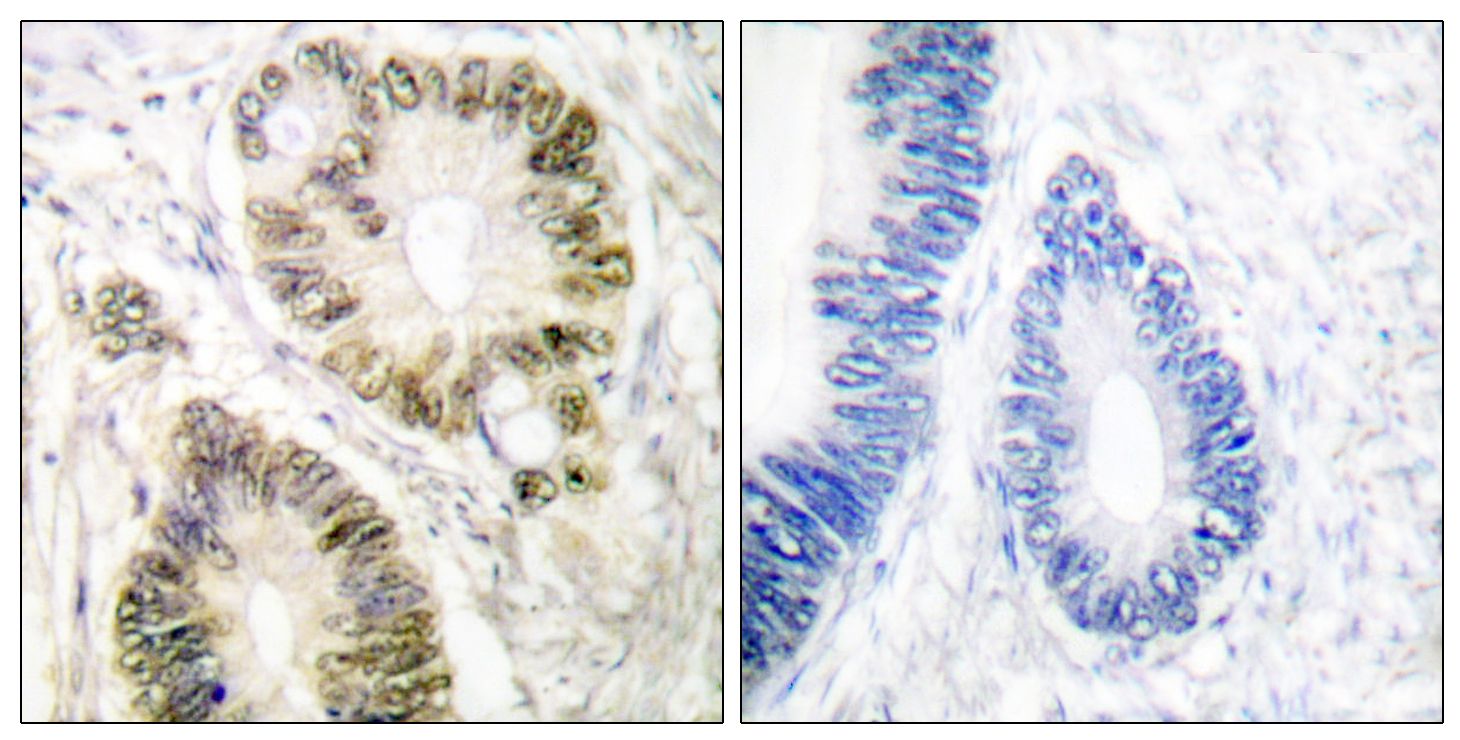 IHC