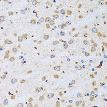Immunohistochemistry - PTRH2 antibody (144-06466)