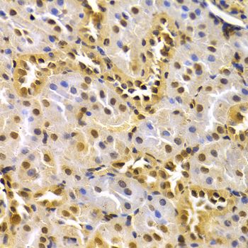 Immunohistochemistry - CDK4 Polyclonal Antibody (144-00366)