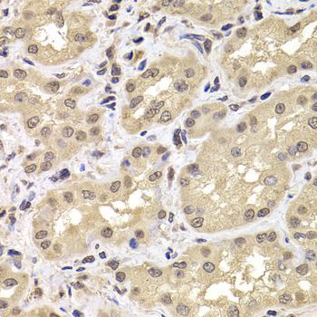 Immunohistochemistry - PSMD12 antibody (144-06708)