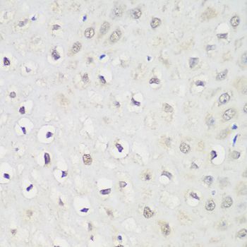 Immunohistochemistry - KPNA3 antibody (144-08347)
