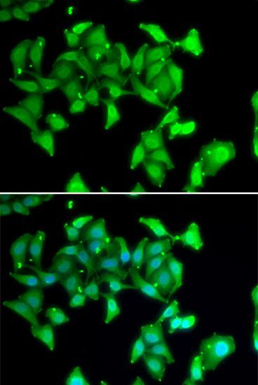 Immunofluorescence - MYO1C Polyclonal Antibody (144-06936)