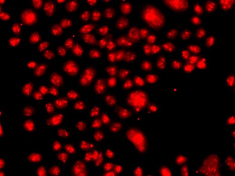 Western blot