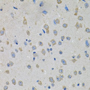 Immunohistochemistry - PTK7 antibody (144-09839)