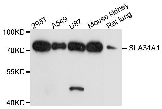 Western blot - SLC34A1 antibody (144-013635)