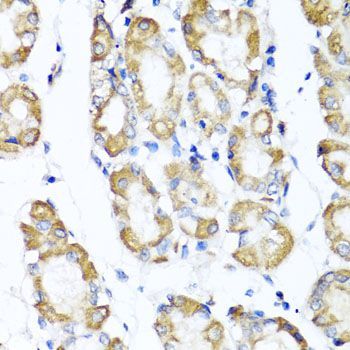 Immunohistochemistry - ST6GAL1 antibody (144-05754)
