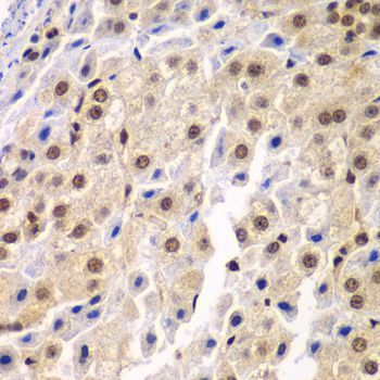 Immunohistochemistry - SF3B2 Polyclonal Antibody (144-05875)