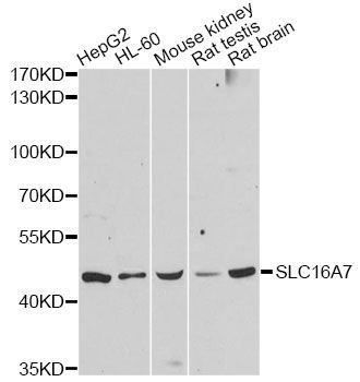 Western blot - SLC16A7 Polyclonal Antibody (144-012386)
