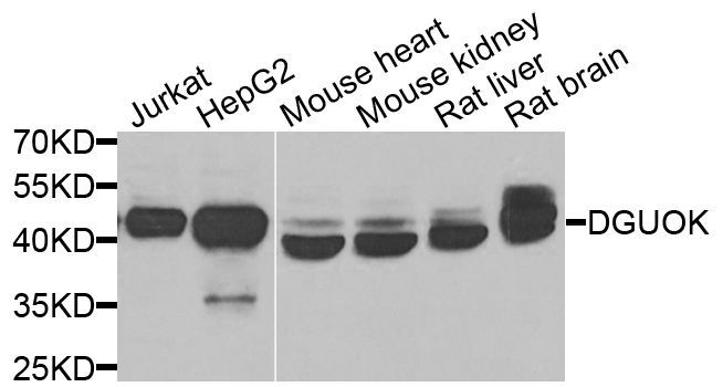 Western blot - DGUOK antibody (144-06898)