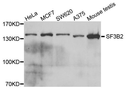 Western blot - SF3B2 Polyclonal Antibody (144-05875)