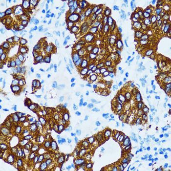 Immunohistochemistry - CTSE antibody (144-02678)