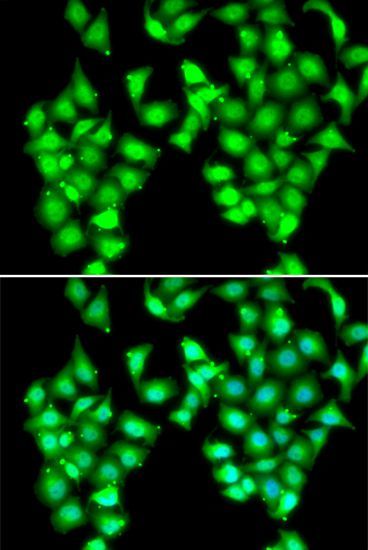Immunofluorescence - ATOH1 Polyclonal Antibody (144-06530)