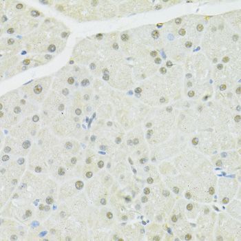 Immunohistochemistry - BRCA1 Polyclonal Antibody (144-11549)