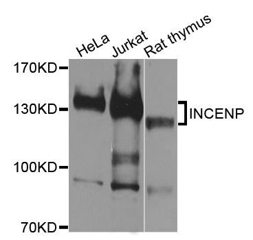 Western blot - INCENP Polyclonal Antibody (144-00622)