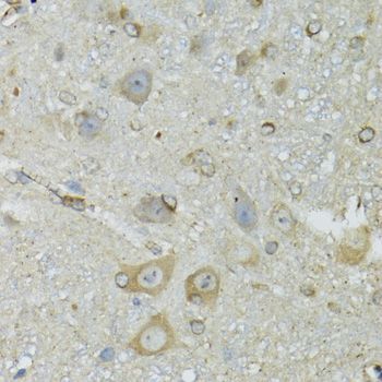 Immunohistochemistry - CRYM antibody (144-03810)