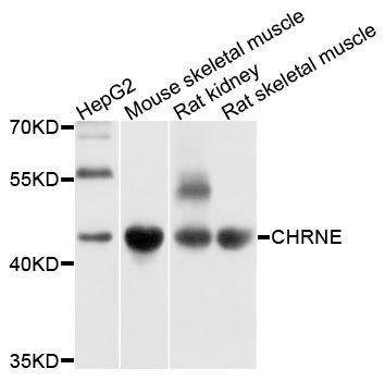 Western blot - CHRNE Polyclonal Antibody (144-10057)