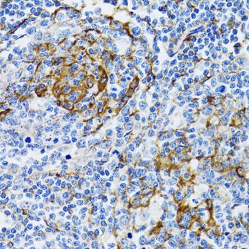 Immunohistochemistry - PGRMC1 antibody (144-05619)