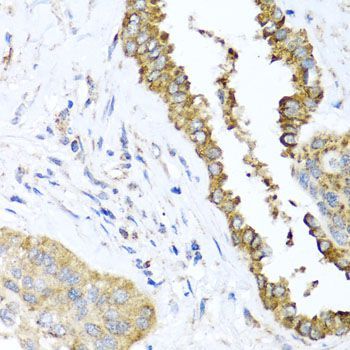 Immunohistochemistry - DFNA5 antibody (144-07432)