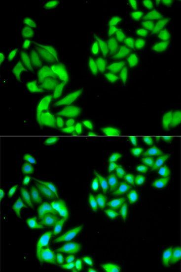 Immunofluorescence - IKBKB antibody (144-02087)