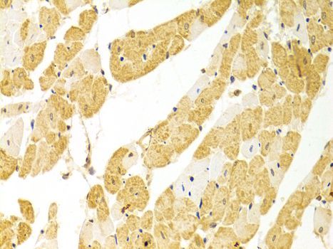 Immunohistochemistry - PLCB1 antibody (144-01971)