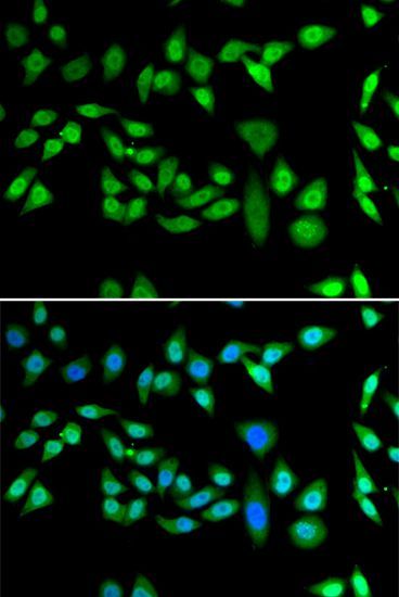 Immunofluorescence - DNAJB6 Polyclonal Antibody (144-07052)