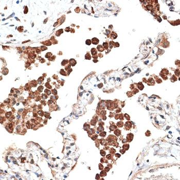 Immunohistochemistry - KTN1 antibody (144-012456)