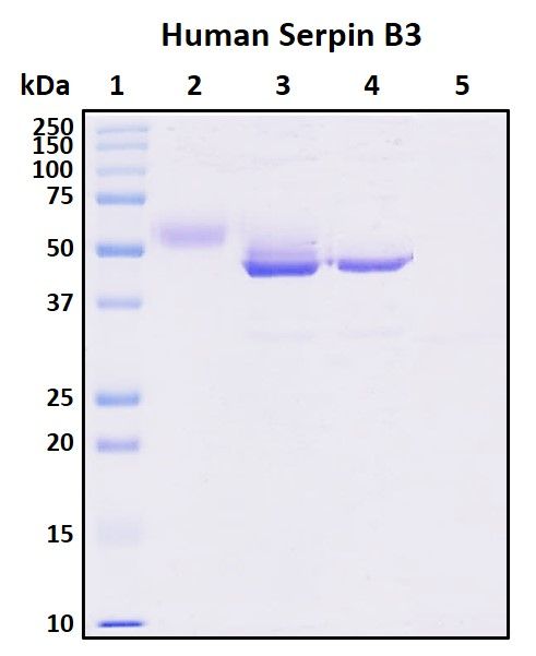 SDS-PAGE