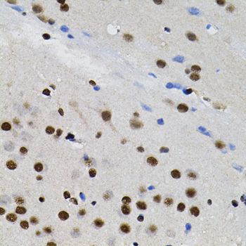 Immunohistochemistry - GTF2I antibody (144-07898)