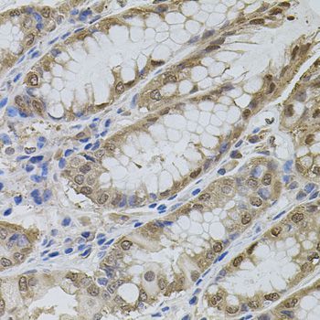 Immunohistochemistry - MAPK1 Polyclonal Antibody (144-011186)