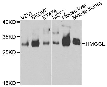 Western blot - HMGCL antibody (144-08052)