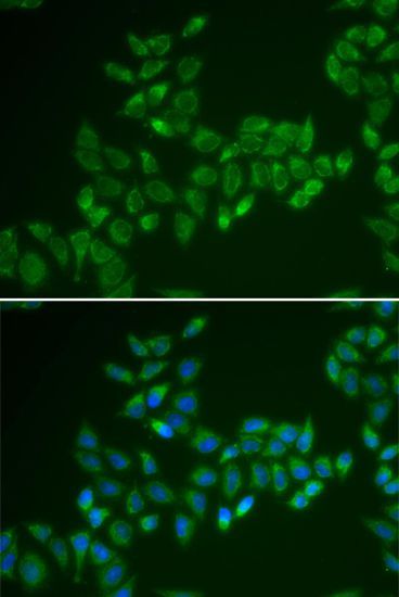 Immunofluorescence - CRAT Polyclonal Antibody (144-06365)