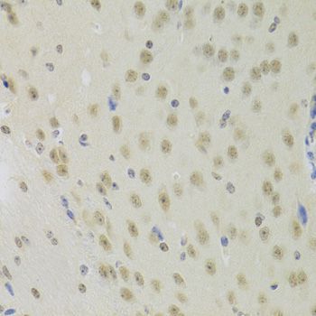 Immunohistochemistry - PRPF3 Polyclonal Antibody (144-05482)