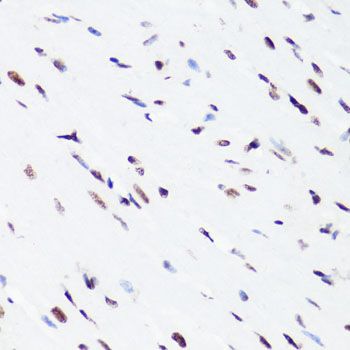 Immunohistochemistry - TriMethyl-Histone H3-K36 pAb (144-02366)