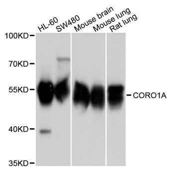 Western blot - CORO1A Polyclonal Antibody (144-09300)