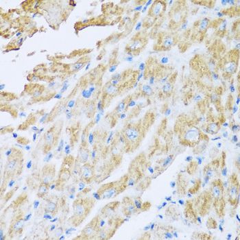 Immunohistochemistry - IL18BP antibody (144-06445)