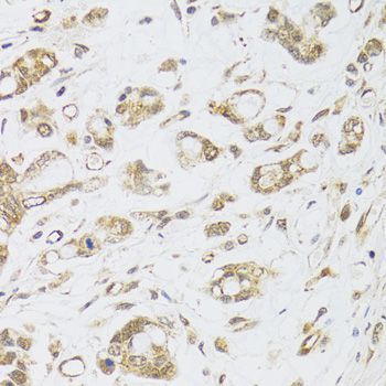 Immunohistochemistry - DMAP1 antibody (144-02324)