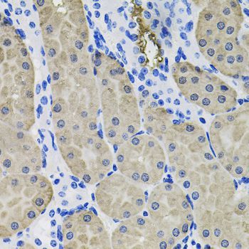 Immunohistochemistry - ACVR2A Polyclonal Antibody (144-01981)