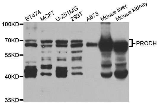 Western blot - PRODH Polyclonal Antibody (144-05836)