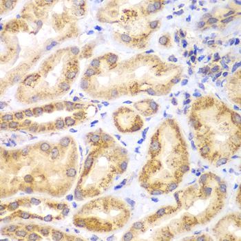 Immunohistochemistry - EYA3 Polyclonal Antibody (144-07893)