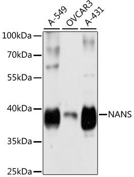 Western blot - NANS antibody (144-61396)