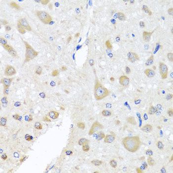 Immunohistochemistry - EIF3M antibody (144-04426)