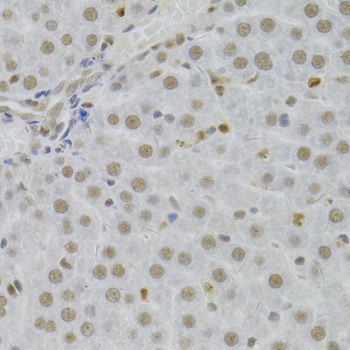 Immunohistochemistry - SFN Polyclonal Antibody (144-01026)