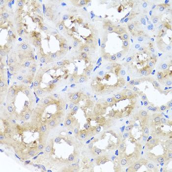 Western blot - GSK3B Polyclonal Antibody (144-06164)
