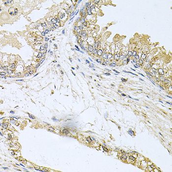 Immunohistochemistry - BCR Polyclonal Antibody (144-00068)