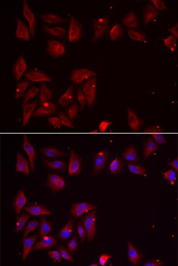 Western blot - PDXK Polyclonal Antibody (144-06687)