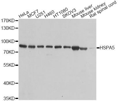 Western blot - HSPA5 Polyclonal Antibody (144-00241)