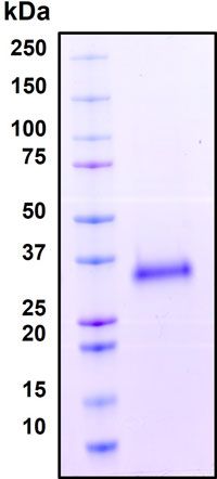 SDS-PAGE