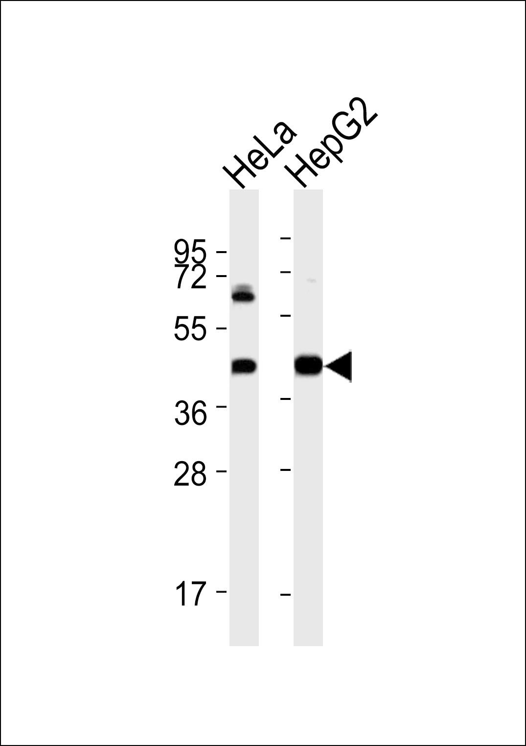 WB