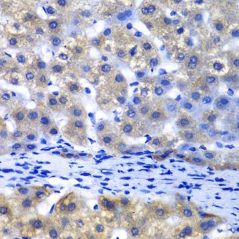 Immunohistochemistry - PSMD8 antibody (144-06955)