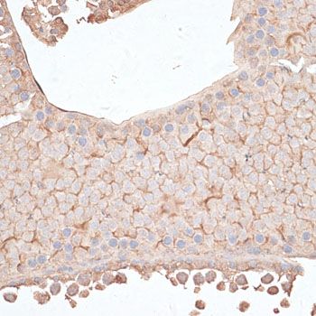 Immunohistochemistry - KIAA1524 antibody (144-012267)